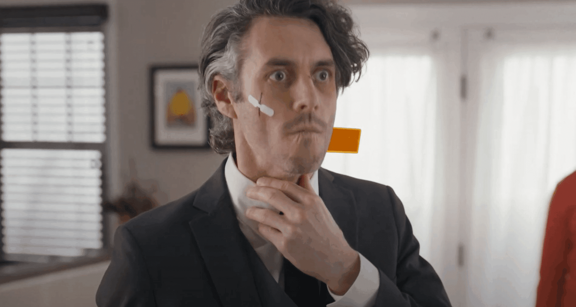 A man in a suit with adhesive bandages on his face holds his hand to his throat, looking surprised or concerned in a bright room with windows in the background.