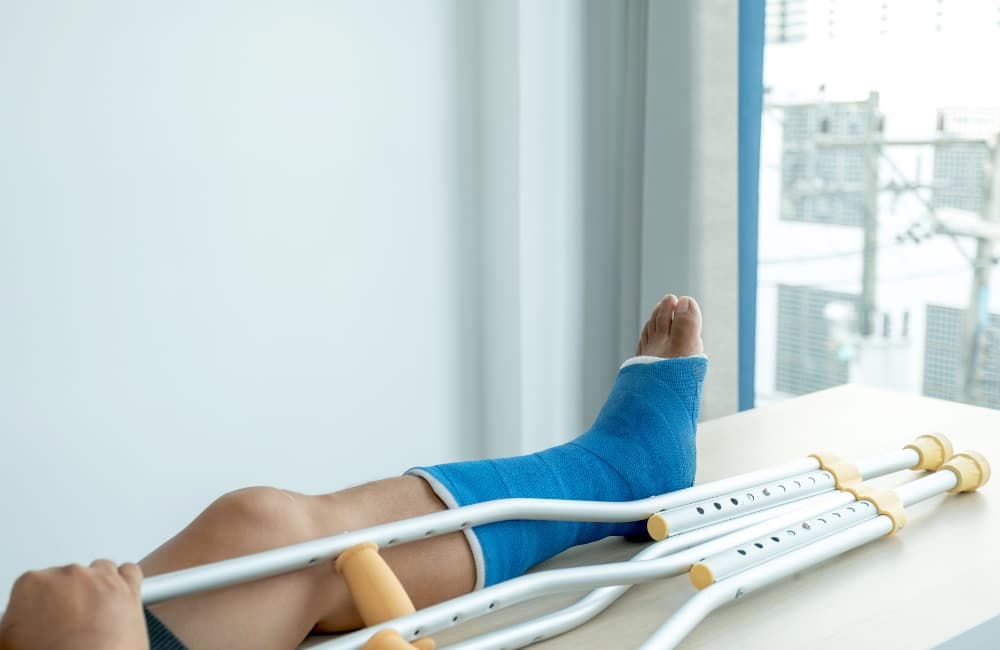 broken bones car accident