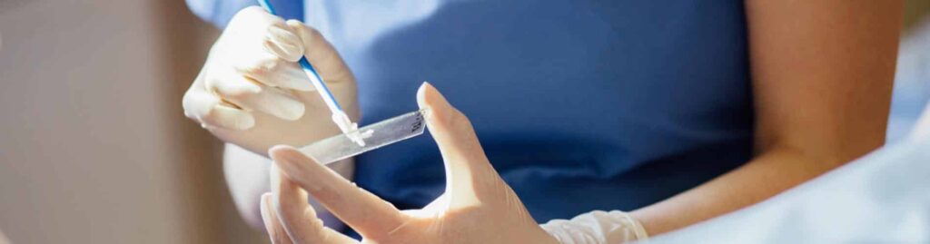A person wearing gloves uses a swab to collect or apply a sample onto a glass slide, likely for medical or laboratory testing, with a blue-clad arm visible in the background.
